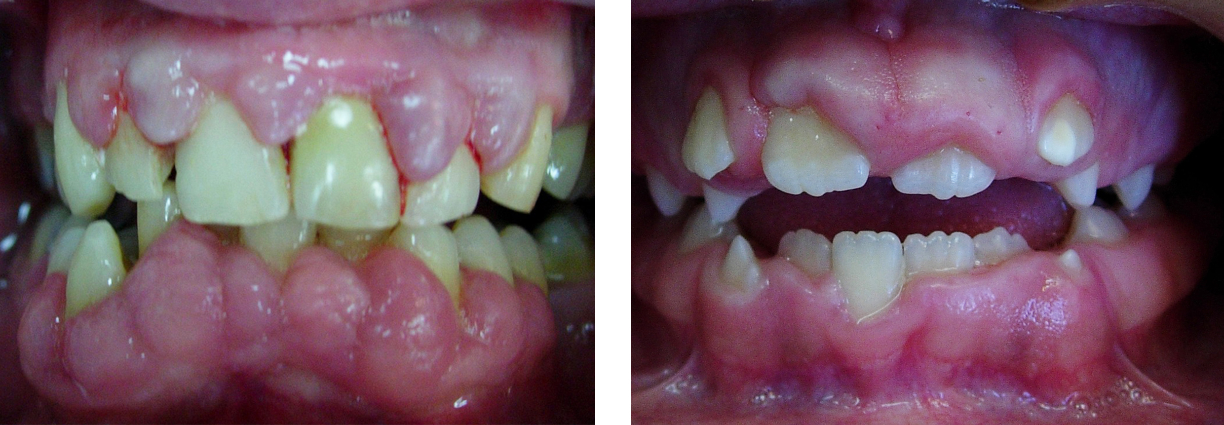 Patients Treated Comitoina