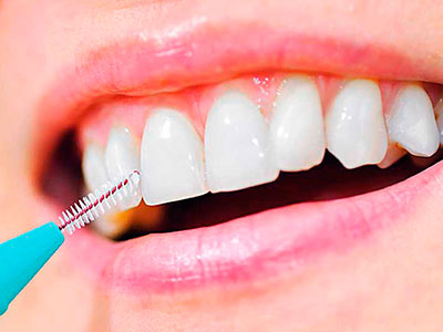 higiene dental - CEPILLO INTERDENTAL