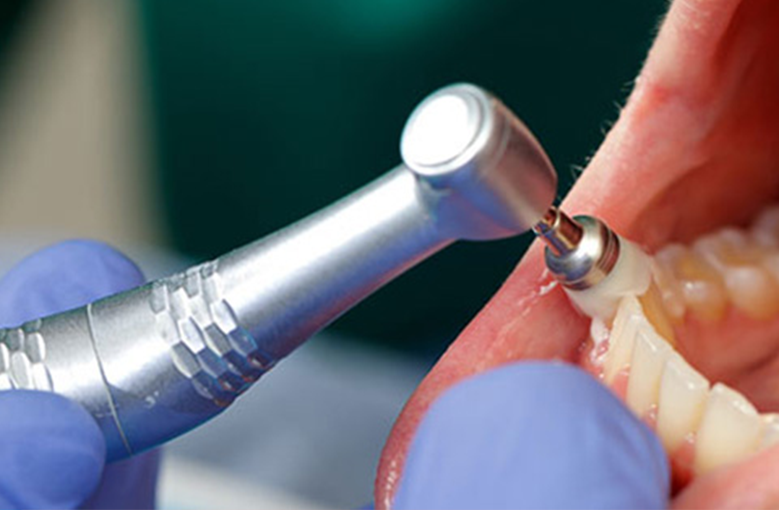 2x2 higiene dental - 