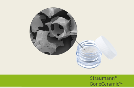 BoneCeramic